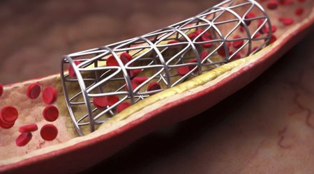 وسایل و دستگاه های قلبی 🔗