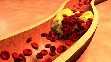 داروهای چربی خون بالا 🔗