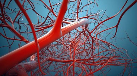 بیماریهای عروق محیطی 🔗