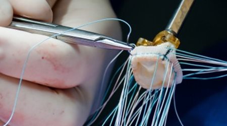 بیماری دریچه‌های قلب 🔗