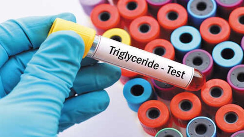 آزمایش چربی خون 🔗