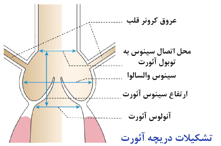 شكل دريچه آئورت