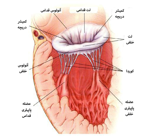 تنگي دريچه ميترال