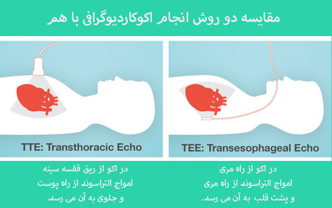 اکو از راه مری