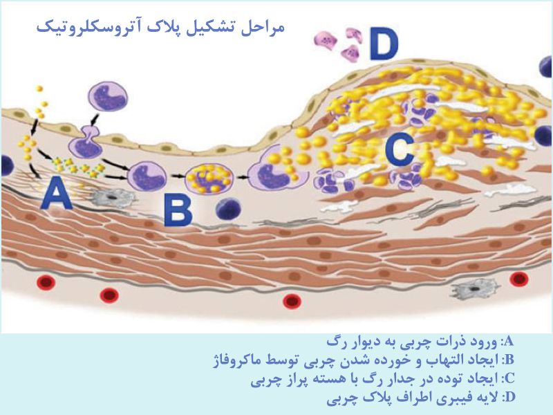 تست ورزش قلب