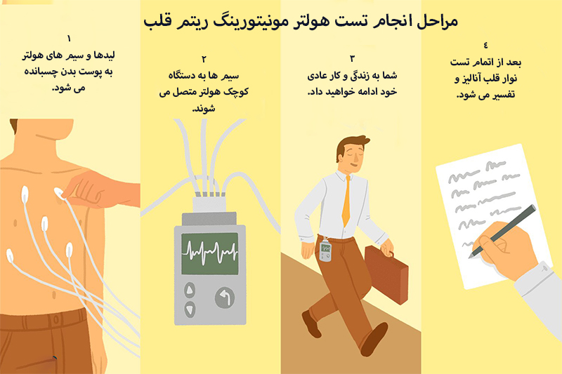 مراحل انجام هولتر قلب