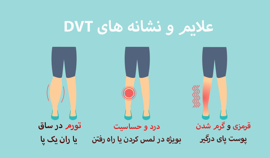 علایم دی وی تی