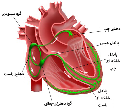 آریتمی قلب