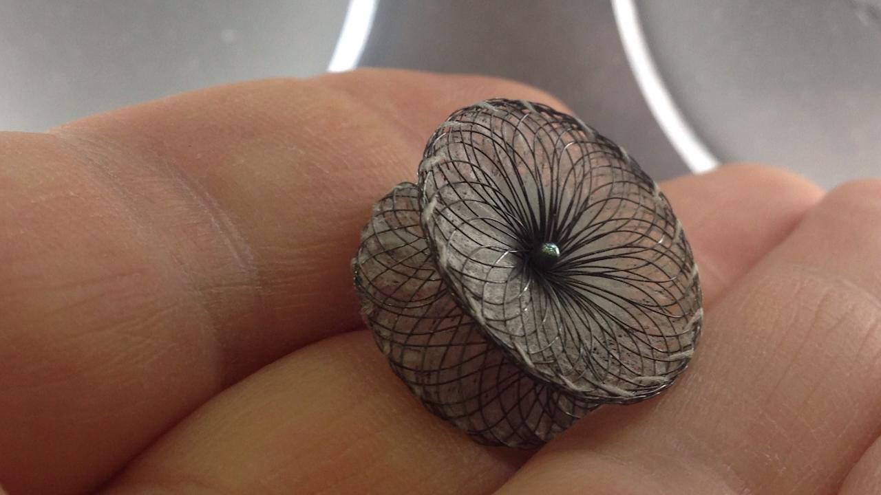 بستن PFO با اینترونشن